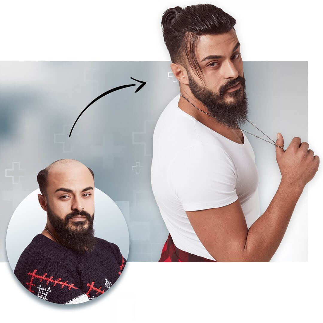 Protez Saç
